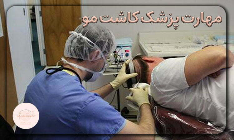 پزشک کاشت مو در تهران