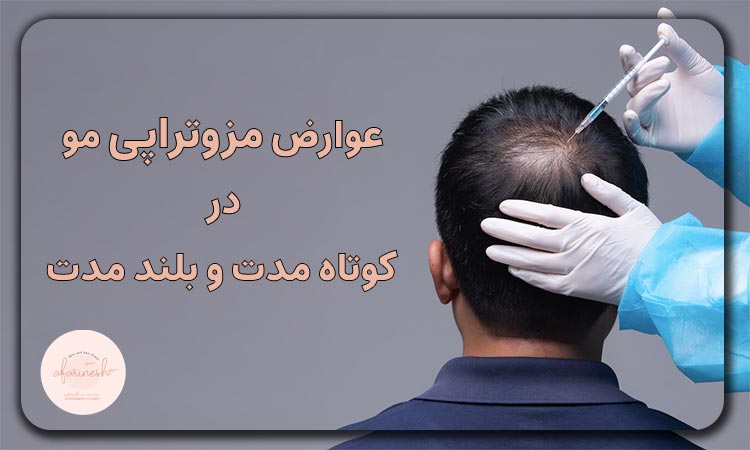 عوارض مزوتراپی مو چیست؟