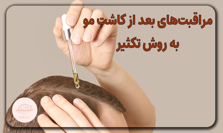 مراقبت‌های بعد از کاشت مو به روش تکثیر
